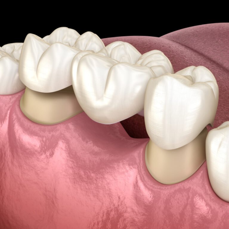 rehab_oral